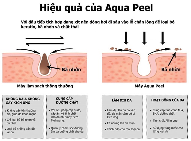 aqua peel có tác dụng gì