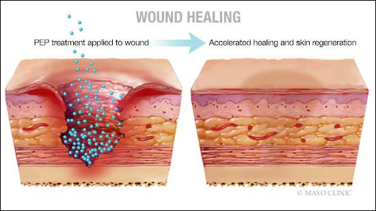 Skin Heal