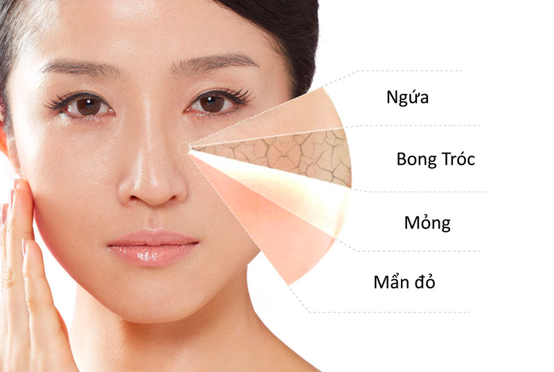Skin healing cho da bị tổn thương do nắng