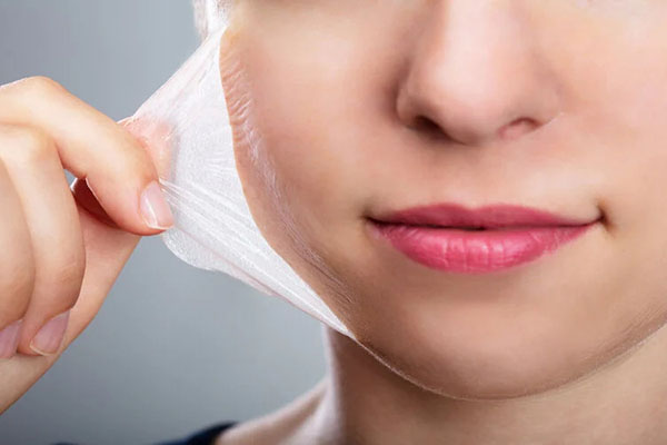 chemical peel tái tạo da