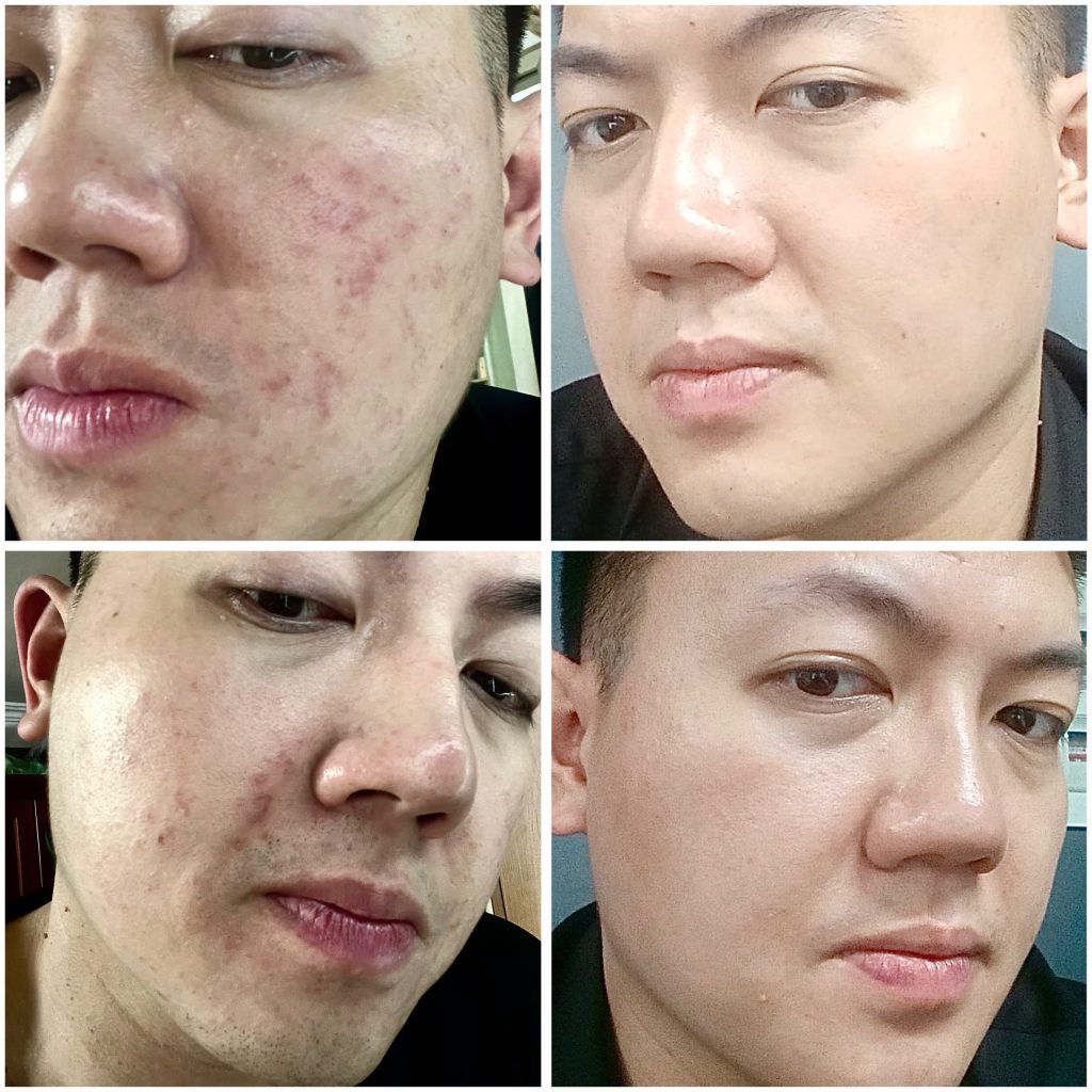 skin healing chăm sóc da nhạy cảm