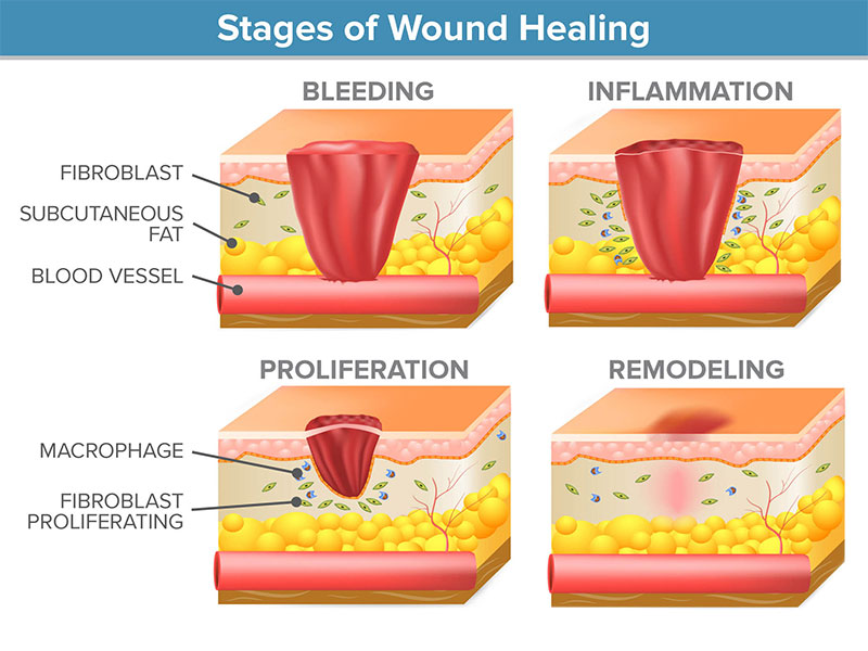 Skin healing cho da bị mụn