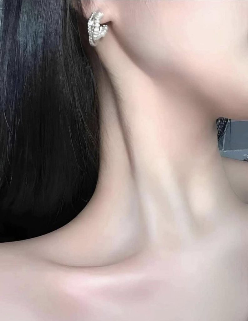 Chemical Peeling Cổ