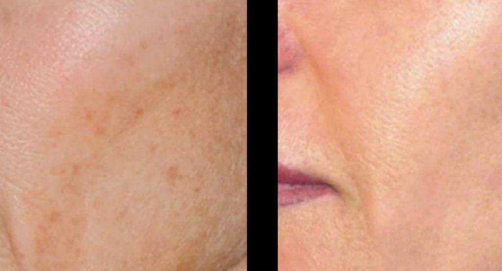 Skin healing vitamins