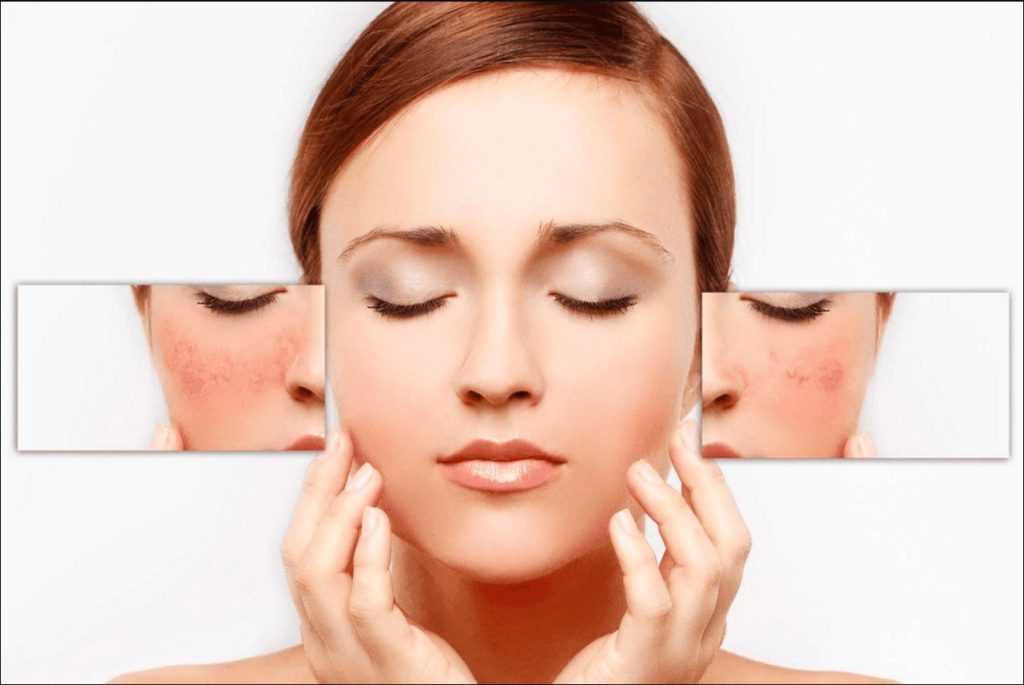 Dịch Vụ Skin Healing