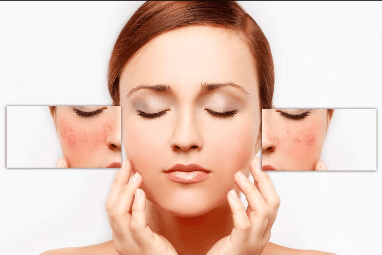 Dịch Vụ Skin Healing